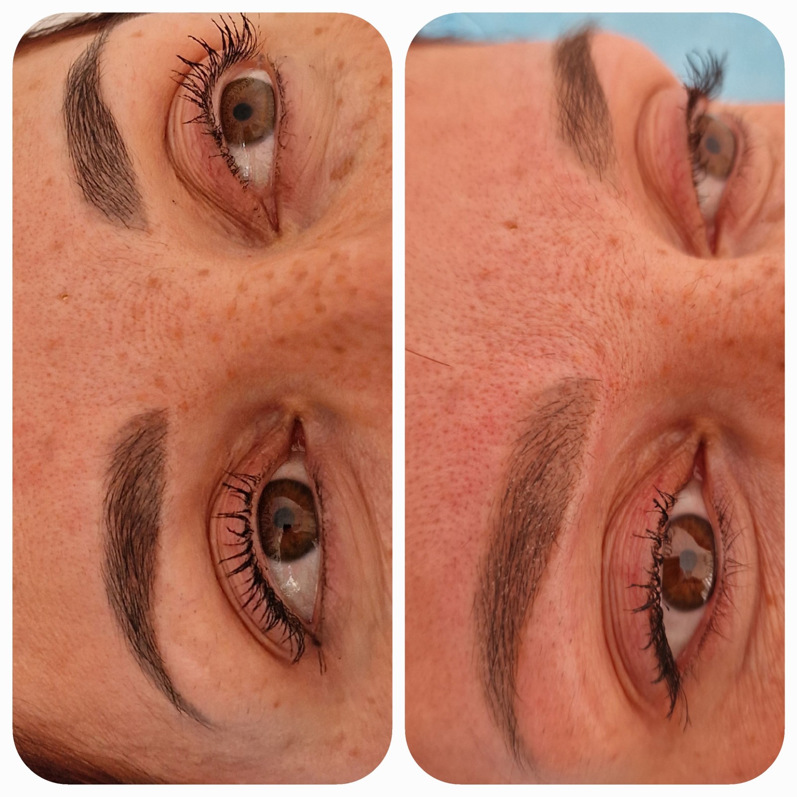 la meilleure methode détatouage sourcils avec l'efficacité double cristal avant après