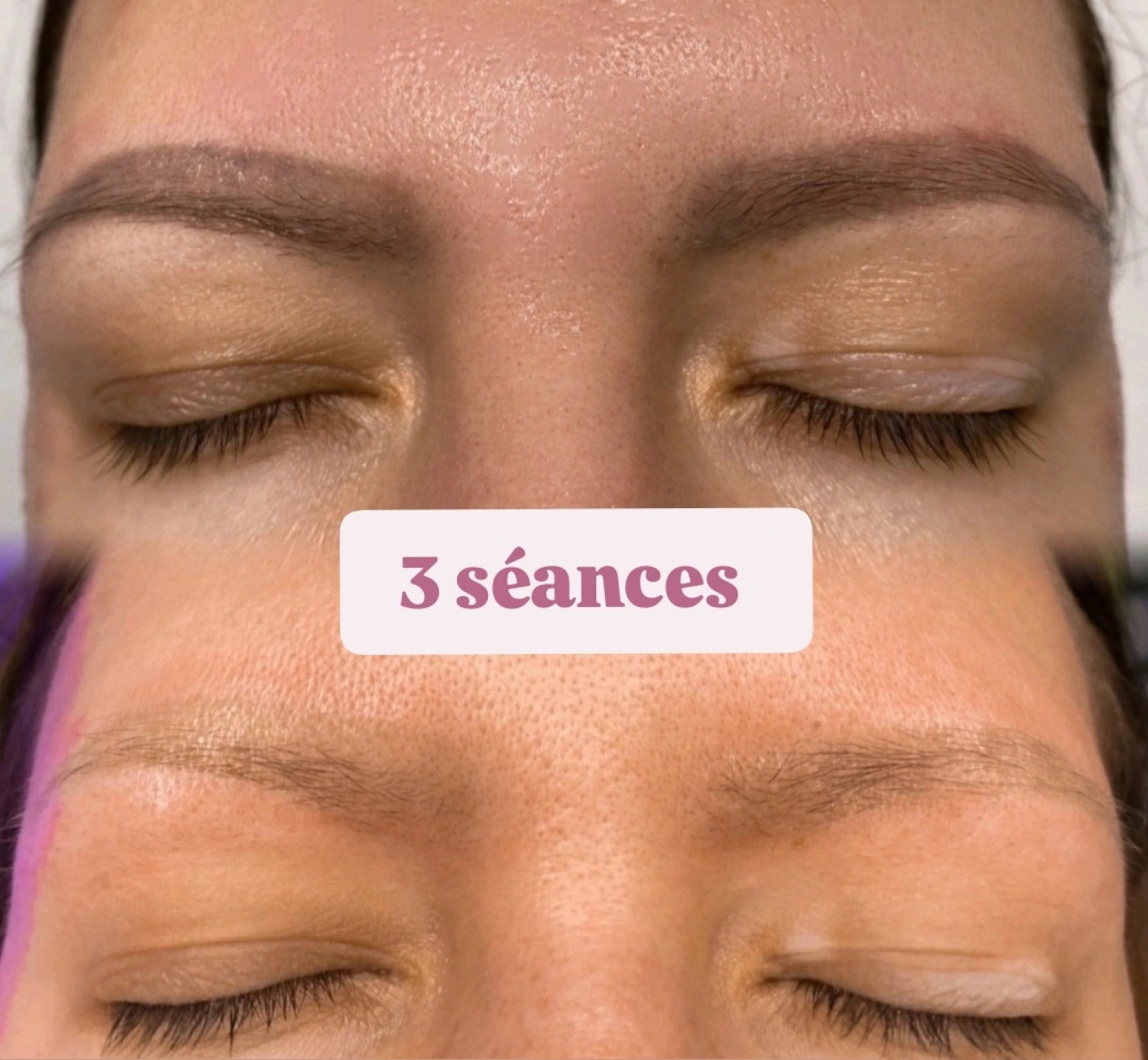 effacer le tatouage des sourcils et de corps naturellement ou avec laser les methodes differentes  de détatouage  La Ciotat Marseille Toulon Aix-en-Provence