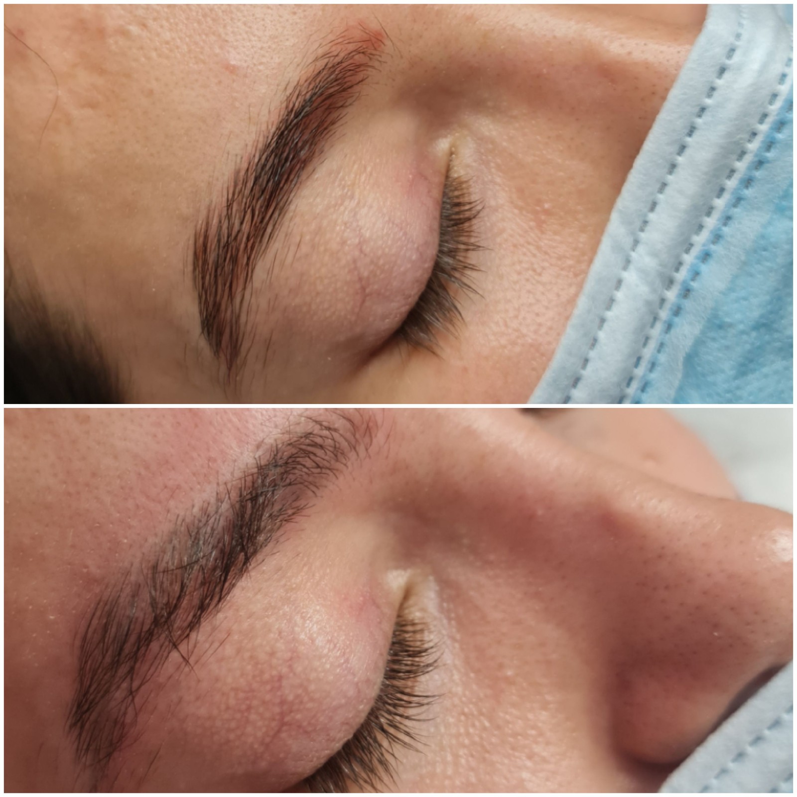 Détatouage combien de séances il faut prévoir pour les sourcils bleus rouges ou violets les résultat avant après? 