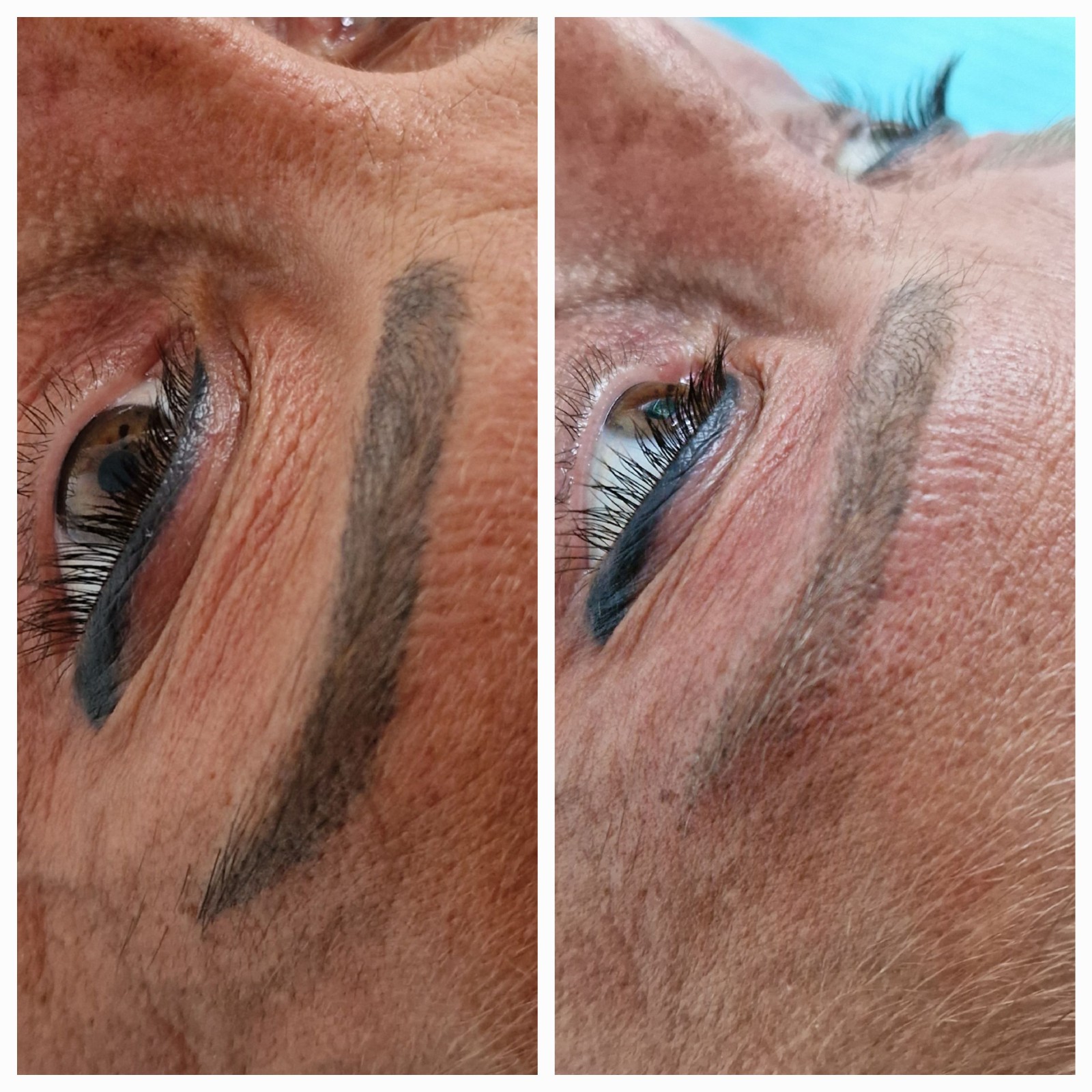 effacer le tatouage des sourcils et de corps naturellement ou avec laser les methodes differentes  de détatouage  La Ciotat Marseille Toulon Aix-en-Provence