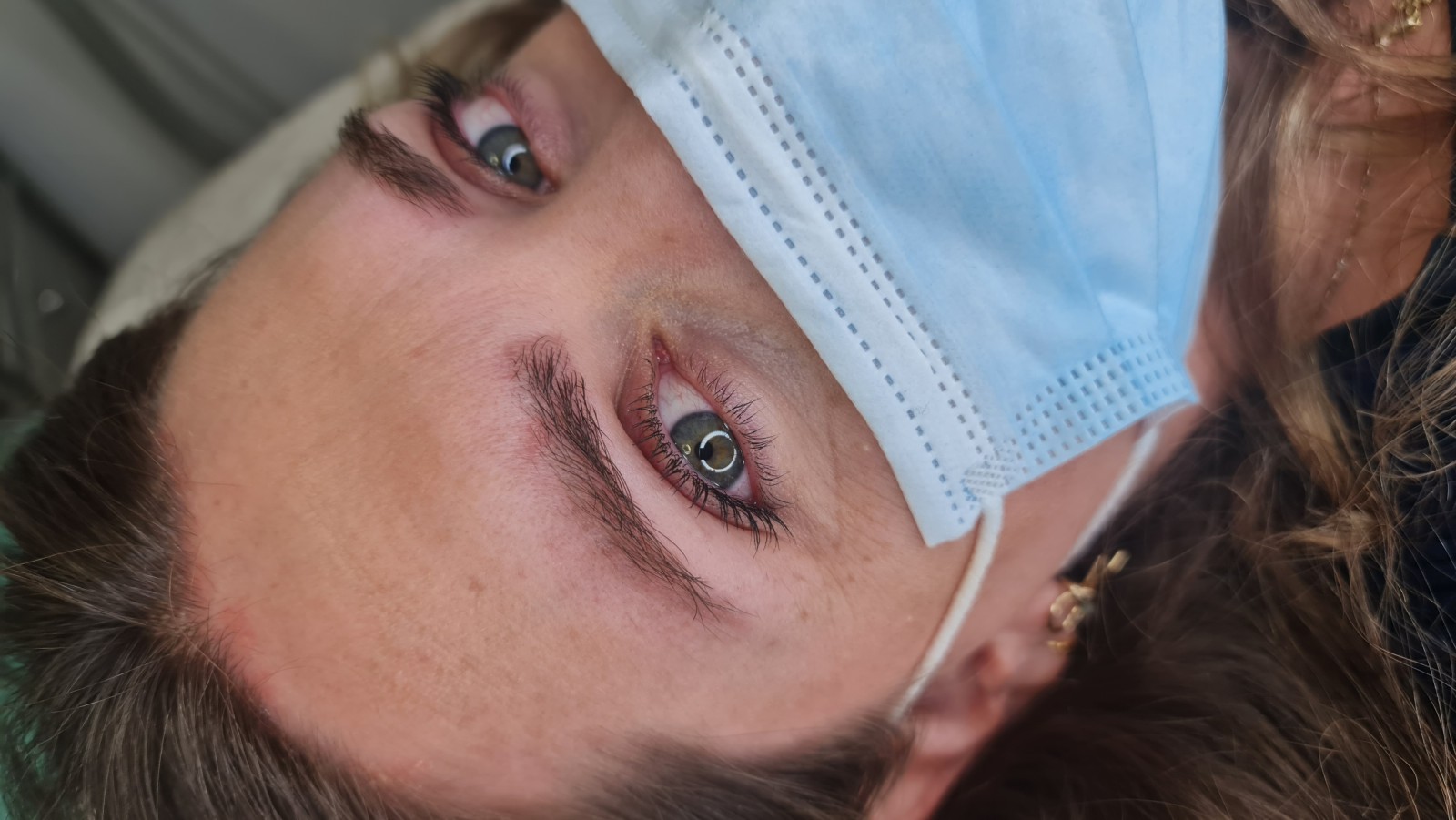 photo détatouage avant/après les meilleurs methodes détatouage sans douleur