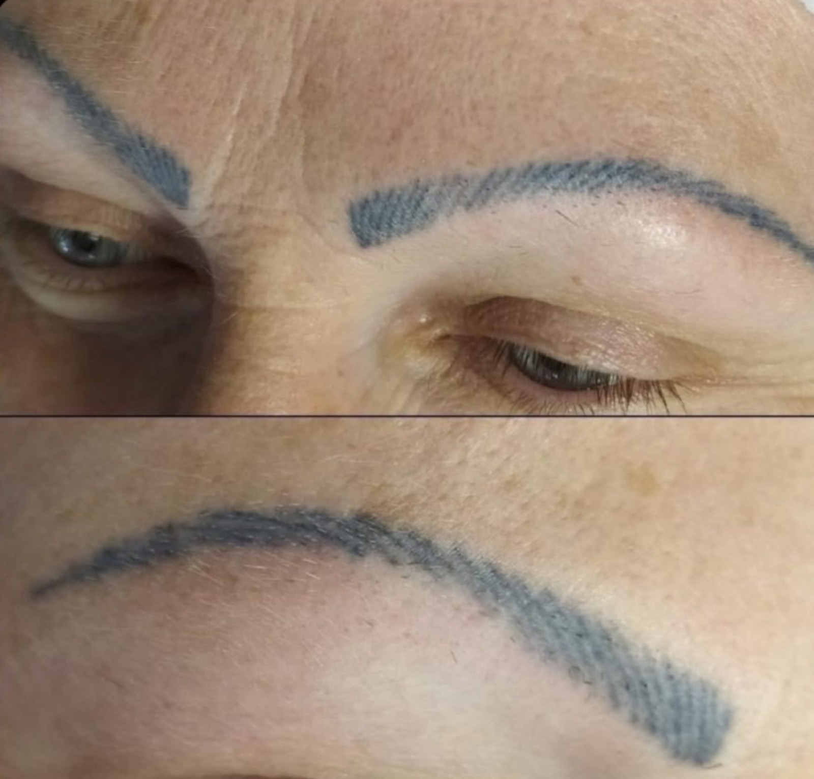 microblading raté comment enlever le tatouage sans douleur et efficacement