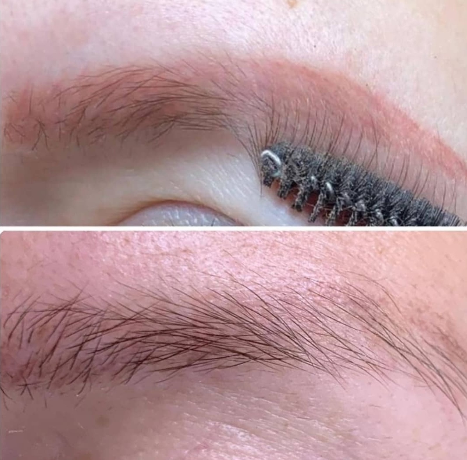 meilleur détatouage sourcils rouges efficace Marseille