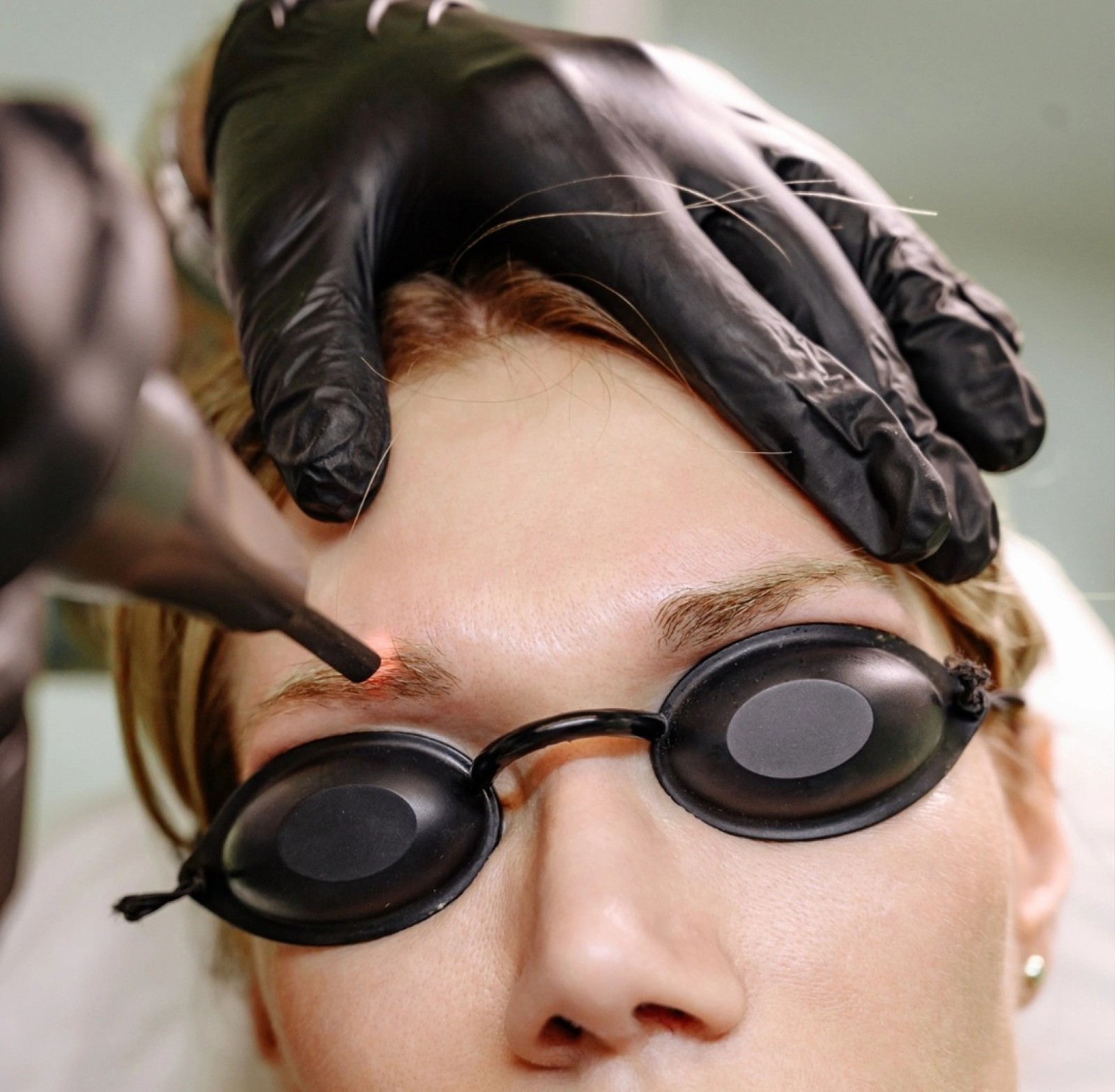 Mini-tatouages : retirez-les en toute sécurité avec notre solution de détatouage dans les Bouches du Rhône