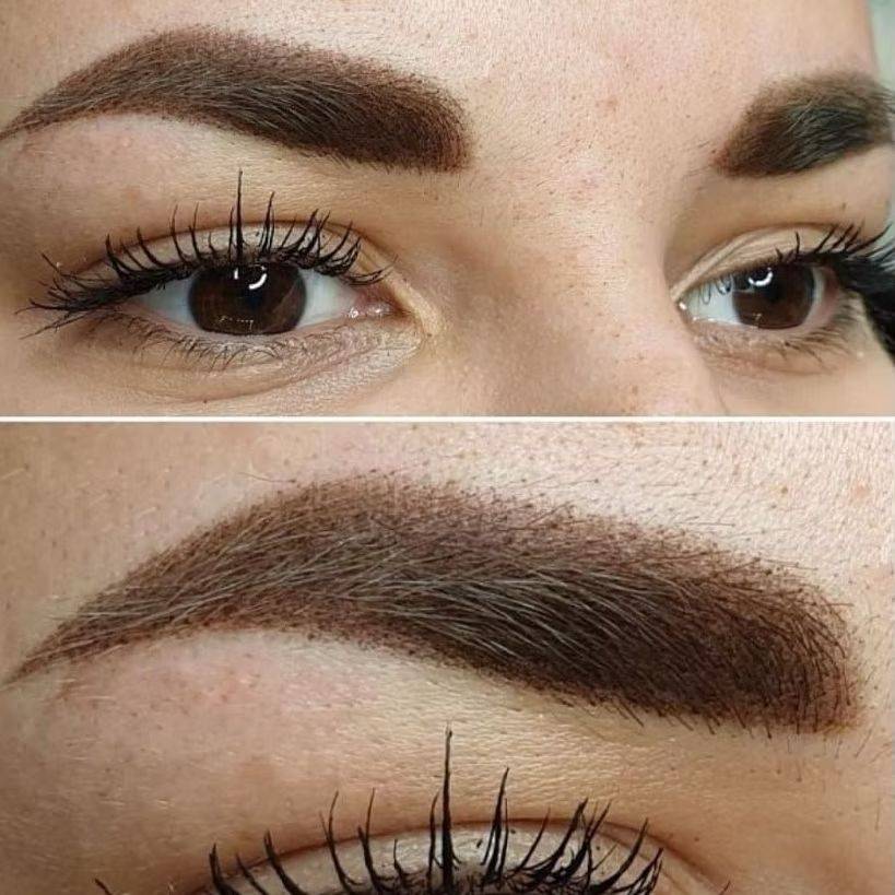 dermopigmentation marseille