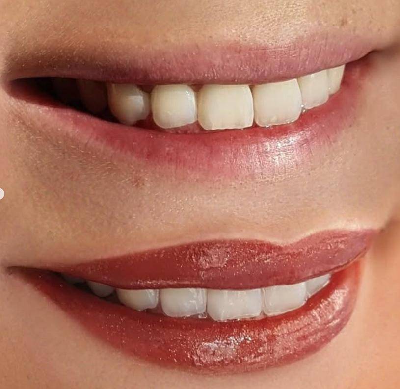 dermopigmentation tatouage levre Marseille