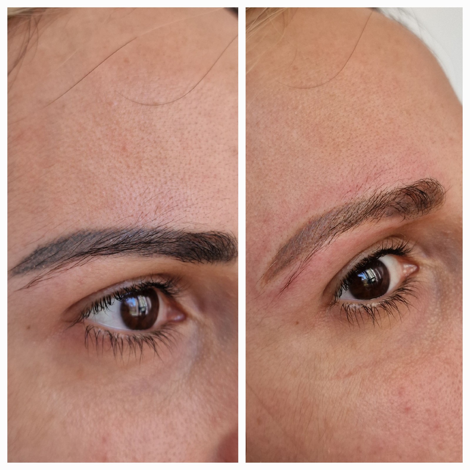 sourcils trops foncés le maquillage permanent devient bleu eclaircissement d'ancien tatoo est possible