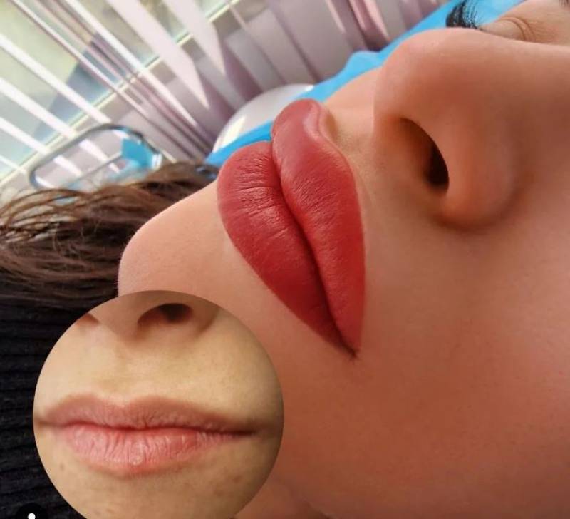 dermopigmentation lèvres Marseille 