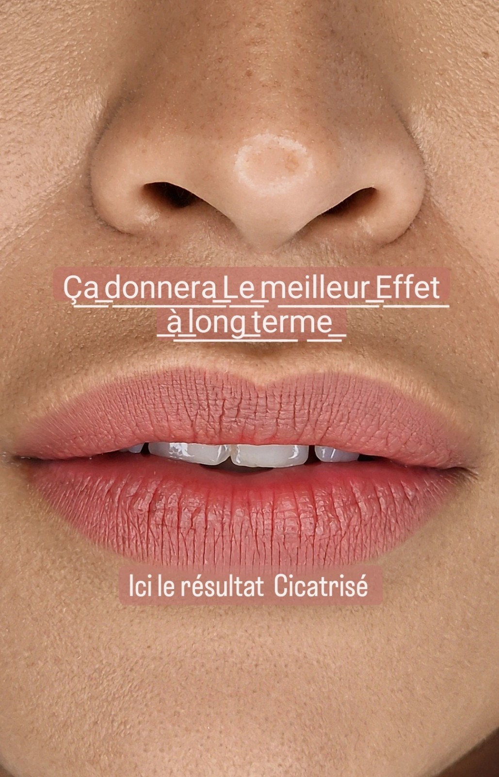 le résultat de maquillage permanent des lèvres cicatrisées
