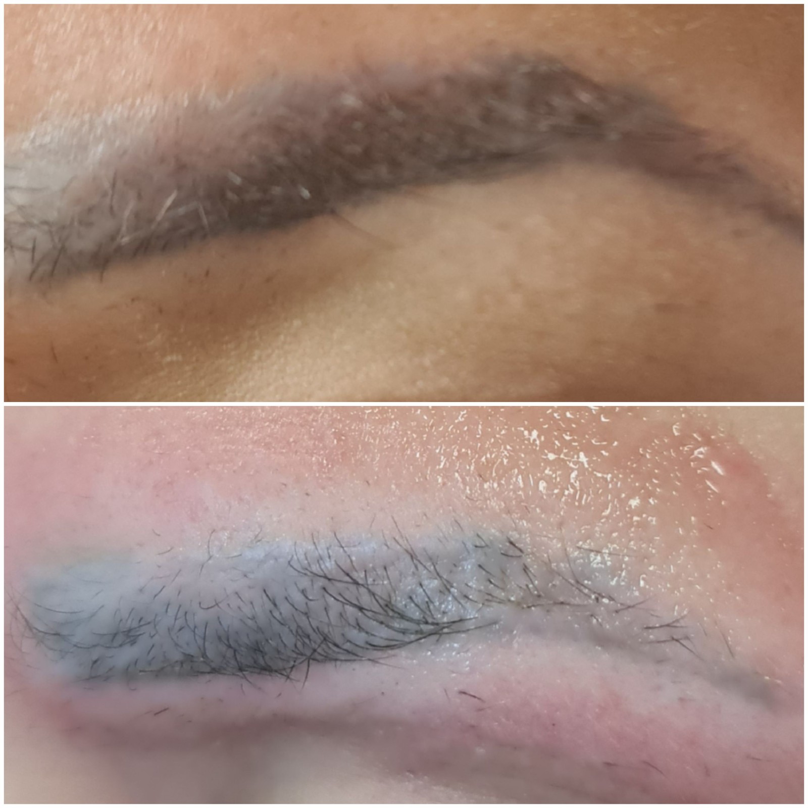 retirer le tatouage Des sourcils efficacement et rapidement Marseille La Ciotat