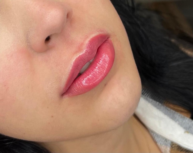 résultat  cicatrisé de dérmopigmentation des lèvres couleur rose naturelle