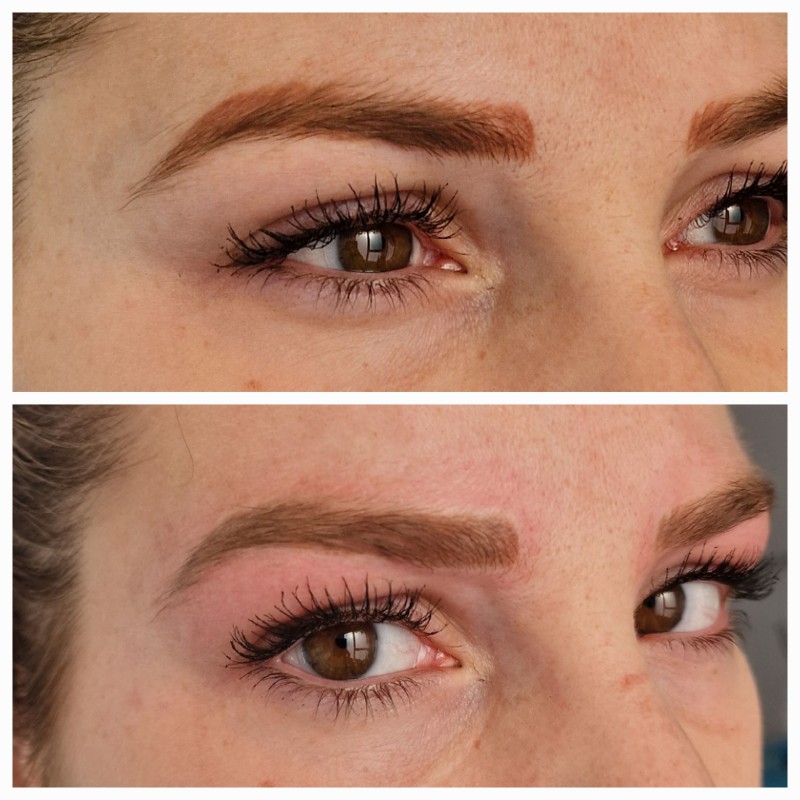 sourcils rouge résultat détatouage grace aux meilleurs methodes d'effacement de tatouage