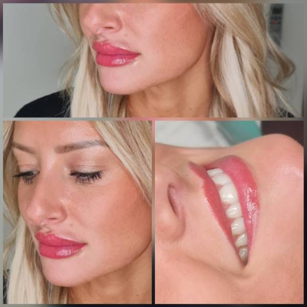 dermopigmentation lèvre marseille