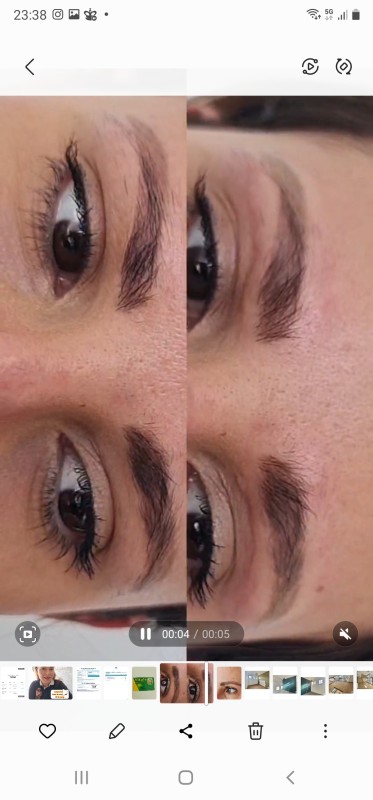 retirer le tatouage Des sourcils efficacement et rapidement Marseille La Ciotat