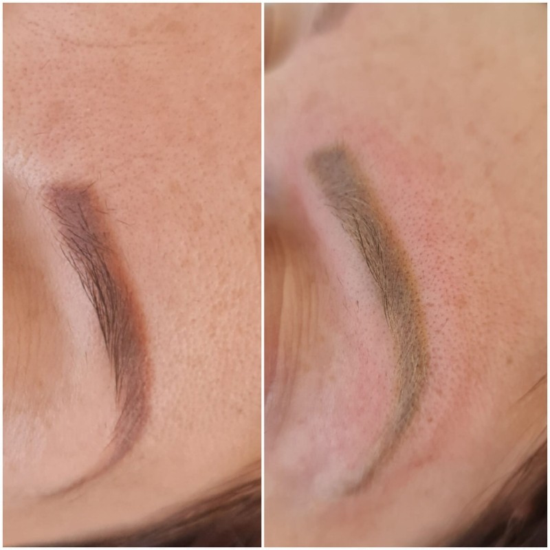 Élimination de tatouages colorés et des sourcils rouges violets résultat visible dès le première séance grace aux technologies  uniques