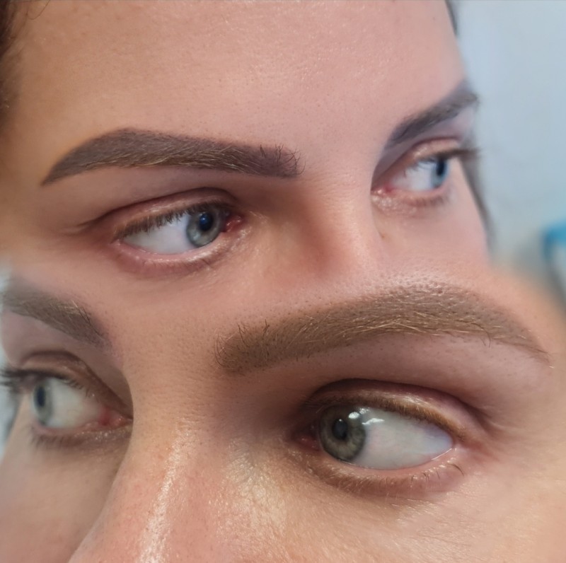 Meilleur détatouage de microblading sourcils rouges Marseille