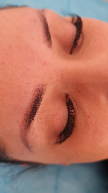Meilleur détatouage de microblading sourcils rouges Marseille