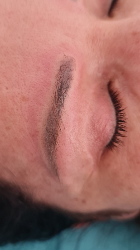 Meilleur détatouage de microblading sourcils rouges Marseille