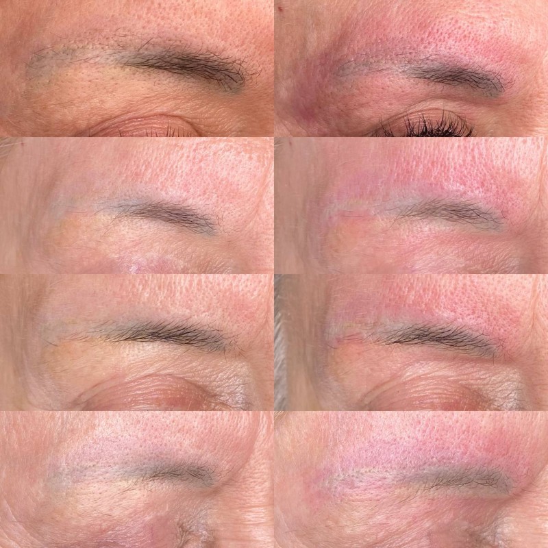 retirer le tatouage Des sourcils efficacement et rapidement Marseille La Ciotat