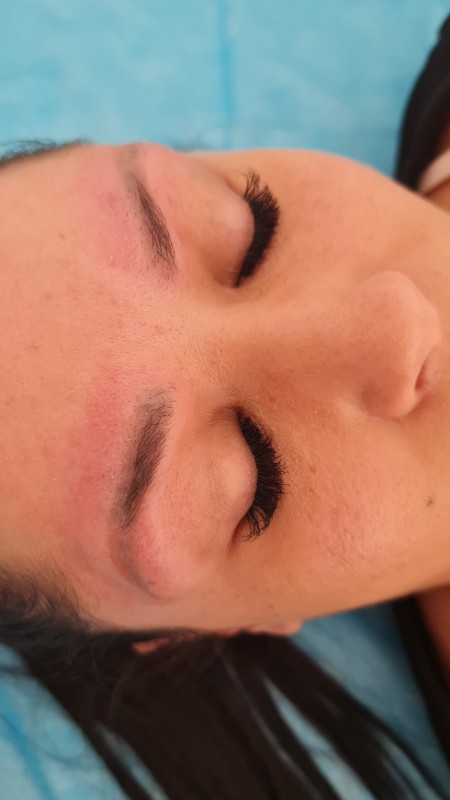 Meilleur détatouage de microblading sourcils rouges Marseille