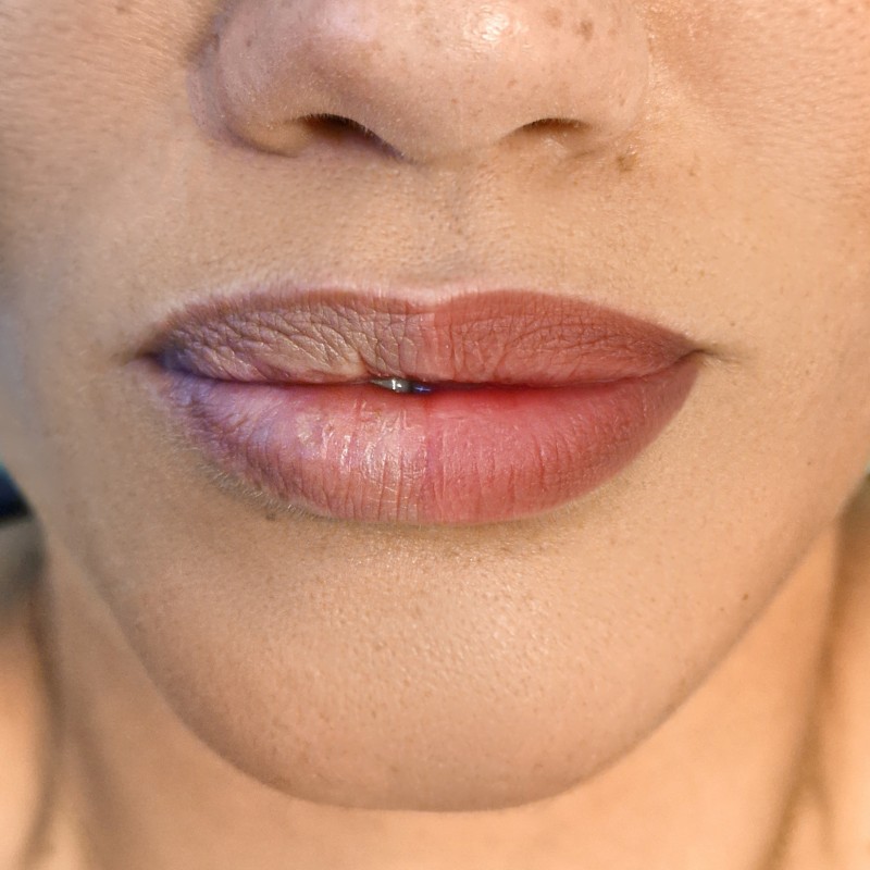 dark lips la solution pour neutraliser les lèvres foncées résultat avant après