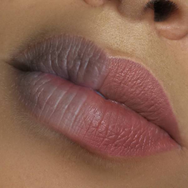 dark lips neutralisation avant après le résultat cicatrisé