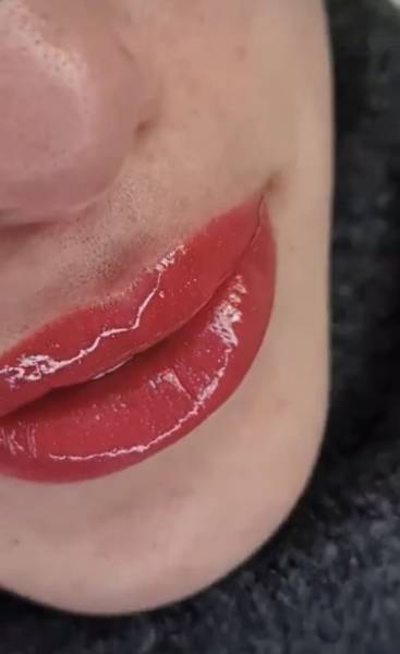 dermopigmentation marseille