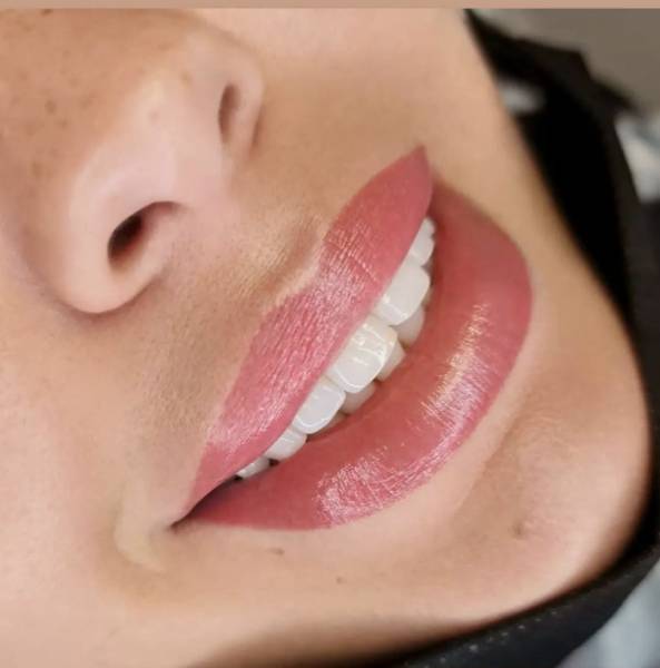 dermopigmentation marseille