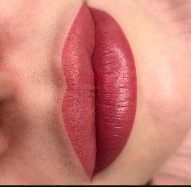 dermopigmentation var