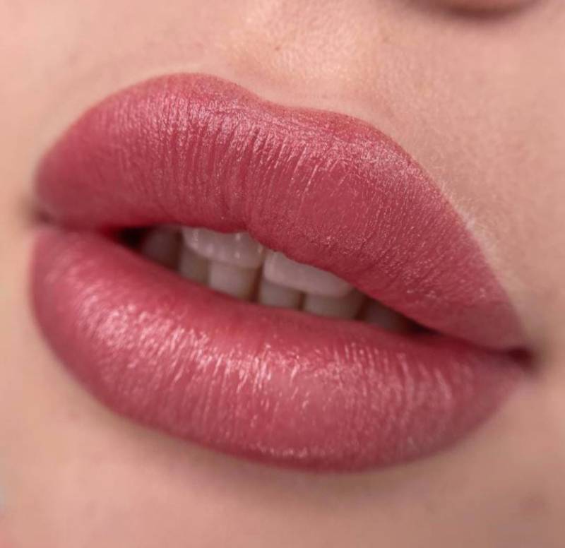 dermopigmentation var