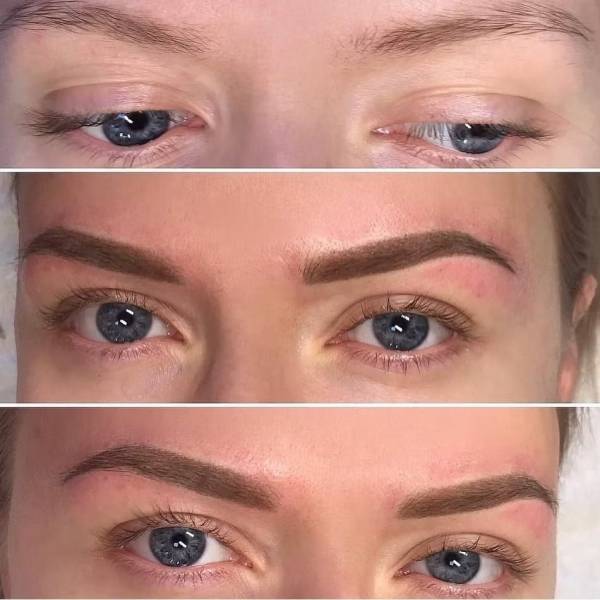 dermopigmentation marseille