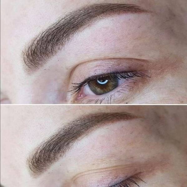 dermopigmentation marseille