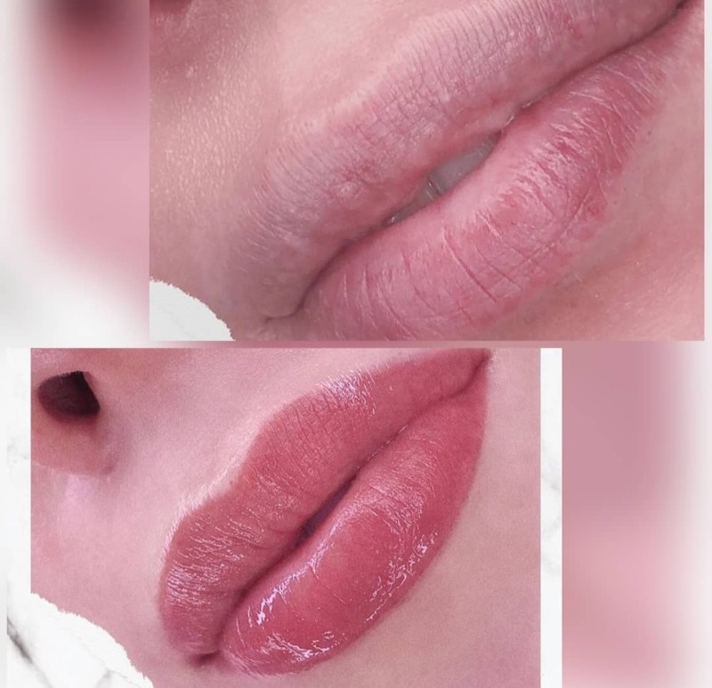 nude lips maquillage pérmanet avant après neutralisation des lèvres pales et sans contour restructuration des lèvres