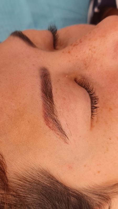 Meilleur détatouage de microblading sourcils rouges Marseille