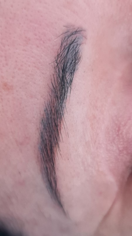 Meilleur détatouage de microblading sourcils rouges Marseille