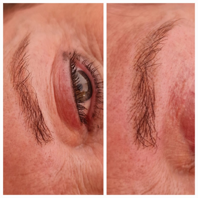 effacer l'ancien maquillage permanent des sourcils methodes naturelles ou laser?