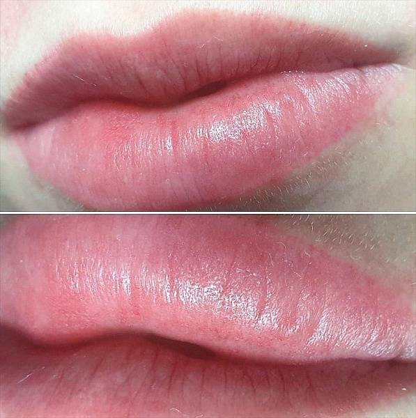 dermopigmentation lèvres Marseille 