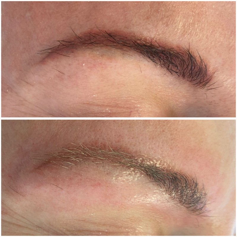 comment évolue détatouage des sourcils rouges judte après la séance