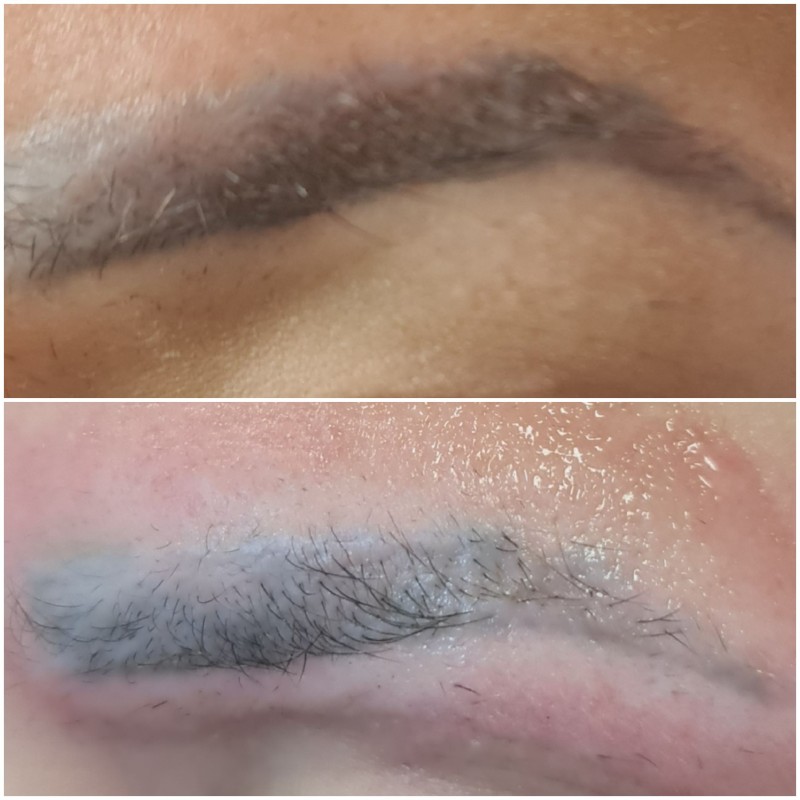 retirer le tatouage Des sourcils efficacement et rapidement Marseille La Ciotat