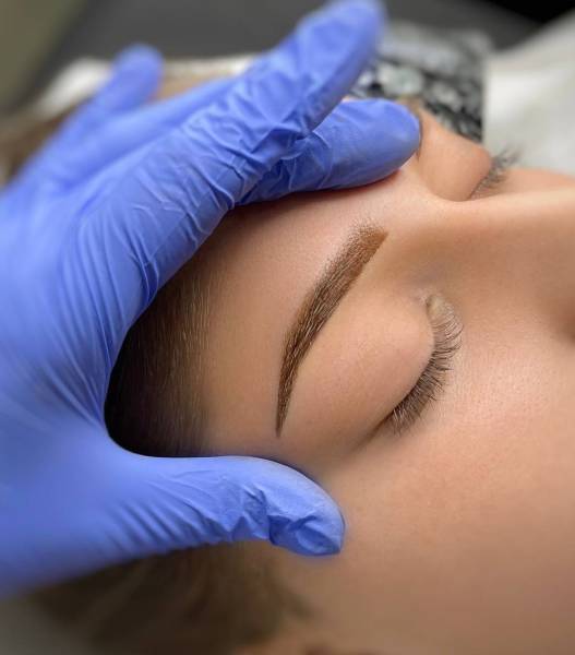 microneedling marseille